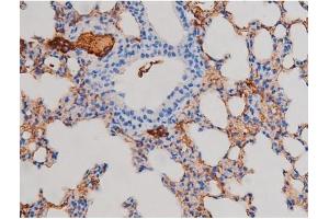 ABIN6267471 at 1/200 staining Mouse lung tissue sections by IHC-P. (AKT1 antibody  (pSer124))