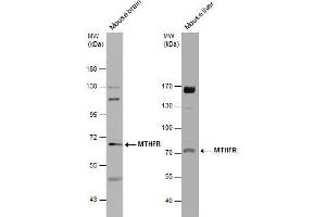 WB Image Various tissue extracts (50 μg) were separated by 7. (MTHFR antibody)