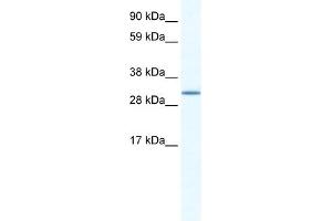 WB Suggested Anti-SPIC Antibody Titration:  1. (SPIC antibody  (N-Term))