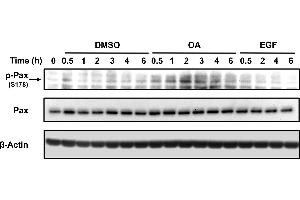 Total protein extracts from serum-starved sub-confluent MDA-MB 231 cells treated with 10 um OA, EGF or DSMO equivalent volume as vehicle control. (Paxillin antibody  (pSer178))