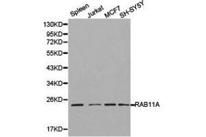 Western Blotting (WB) image for anti-RAB11A, Member RAS Oncogene Family (RAB11A) antibody (ABIN1874497) (RAB11A antibody)