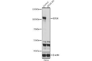 Western blot analysis of extracts from normal (control) and EEF2K knockout (KO) HeLa cells, using EEF2K antibody (ABIN6130354, ABIN6139955, ABIN6139956 and ABIN7101771) at 1:1000 dilution. (EEF2K antibody  (AA 406-725))