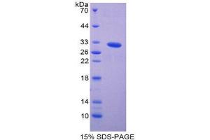 SDS-PAGE (SDS) image for P21-Activated Kinase 2 (PAK2) (AA 177-419) protein (His tag) (ABIN2126213) (PAK2 Protein (AA 177-419) (His tag))