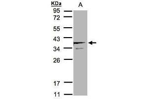 WB Image Sample(30 μg of whole cell lysate) A:MOLT4, 12% SDS PAGE antibody diluted at 1:2000