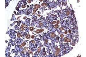 Formalin-fixed and paraffin embedded: rat submaxillary gland labeled with Anti-ER-alpha Polyclonal Antibody (ABIN725300), Unconjugated at 1:200 followed by conjugation to the secondary antibody and DAB staining (Estrogen Receptor alpha antibody  (AA 331-360))