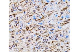 Immunohistochemistry of paraffin-embedded Rat brain using MAP1LC3A Polyclonal Antibody at dilution of 1:100 (40x lens). (MAP1LC3A antibody)