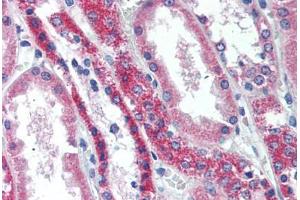 Human Kidney (formalin-fixed, paraffin-embedded) stained with TNFRSF11A antibody ABIN296495 at 10 ug/ml followed by biotinylated goat anti-rabbit IgG secondary antibody ABIN481713, alkaline phosphatase-streptavidin and chromogen. (TNFRSF11A antibody  (AA 603-613))