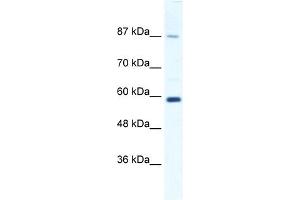 WB Suggested Anti-KIF23 Antibody Titration:  1. (KIF23 antibody  (N-Term))
