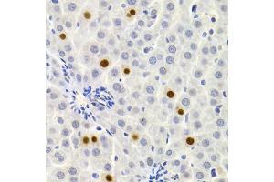 Immunohistochemistry of paraffin-embedded rat liver using GEMIN2 Antibody (ABIN1872798) at dilution of 1:200 (40x lens). (SIP1 antibody)