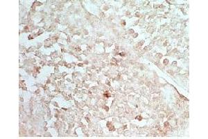 Rat testis tissue stained by Rabbit Anti-INSL5  (Mouse) Serum