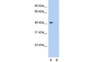 Host:  Rabbit  Target Name:  PCBP1  Sample Type:  HepG2  Lane A:  Primary Antibody  Lane B:  Primary Antibody + Blocking Peptide  Primary Antibody Concentration:  2. (PCBP1 antibody  (Middle Region))