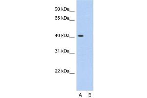 Host:  Rabbit  Target Name:  PCBP1  Sample Type:  HepG2  Lane A:  Primary Antibody  Lane B:  Primary Antibody + Blocking Peptide  Primary Antibody Concentration:  2.