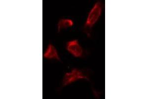 ABIN6278185 staining HepG2 by IF/ICC. (PNPLA2 antibody  (Internal Region))