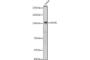 Western blot analysis of extracts of Jurkat cells, using S antibody (ABIN6130296, ABIN6147396, ABIN6147398 and ABIN6221485) at 1:1000 dilution. (SATB1 antibody  (AA 484-763))