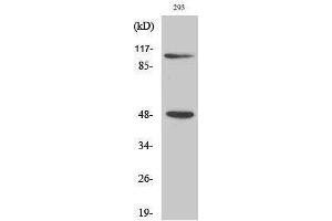 Western Blotting (WB) image for anti-Nuclear Factor of kappa Light Polypeptide Gene Enhancer in B-Cells 1 (NFKB1) (Thr157) antibody (ABIN3180208) (NFKB1 antibody  (Thr157))