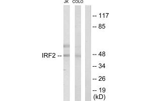 Western blot analysis of extracts from Jurkat cells and COLO205 cells, using IRF2 antibody.