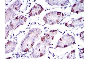 Immunohistochemical analysis of paraffin-embedded stomach tissues using SLC27A5 mouse mAb with DAB staining. (SLC27A5 antibody  (AA 508-570))