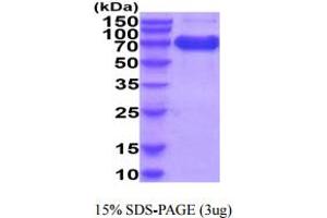 SDS-PAGE (SDS) image for Interleukin 2 Receptor, alpha (IL2RA) (AA 22-240) protein (hIgG-His-tag) (ABIN5854928) (CD25 Protein (AA 22-240) (hIgG-His-tag))