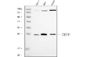 Western blot analysis of TRIR using anti-TRIR antibody (ABIN7603244). (Uncharacterized Protein C19orf43 (TRIR) (N-Term) antibody)