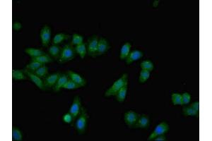 Immunofluorescent analysis of HepG2 cells using ABIN7143786 at dilution of 1:100 and Alexa Fluor 488-congugated AffiniPure Goat Anti-Rabbit IgG(H+L) (Fetuin A antibody  (AA 20-296))