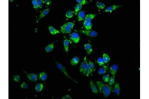 Immunofluorescence staining of Hela cells with ABIN7174460 at 1:166, counter-stained with DAPI. (UBE2K antibody  (AA 2-200))