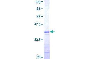 TRIM68 Protein (AA 181-280) (GST tag)