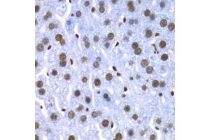 Immunohistochemistry (Paraffin-embedded Sections) (IHC (p)) image for anti-Splicing Factor 3b, Subunit 2, 145kDa (SF3B2) (AA 616-895) antibody (ABIN6147666)