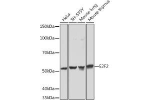 Western blot analysis of extracts of various cell lines, using E2F2 Rabbit mAb (ABIN1680064, ABIN3017656, ABIN3017657 and ABIN7101516) at 1:1000 dilution. (E2F2 antibody)
