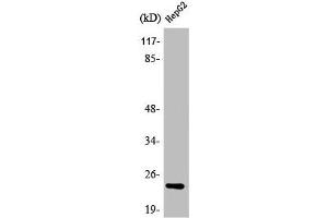 Western Blot analysis of Jurkat cells using ATP5H Polyclonal Antibody (ATP5H antibody  (C-Term))