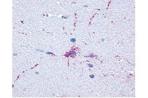 Brain, Neurons and Glia (GRM8 antibody  (C-Term))
