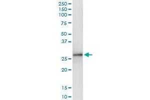 Immunoprecipitation of SLA2 transfected lysate using anti-SLA2 MaxPab rabbit polyclonal antibody and Protein A Magnetic Bead , and immunoblotted with SLA2 MaxPab mouse polyclonal antibody (B01) . (SLAP2 antibody  (AA 1-261))