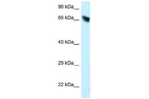 Western Blot showing CES3 antibody used at a concentration of 1 ug/ml against HepG2 Cell Lysate