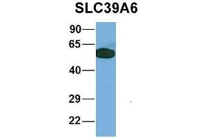 Host:  Rabbit  Target Name:  HIRIP3  Sample Type:  293T  Antibody Dilution:  1. (SLC39A6 antibody  (Middle Region))