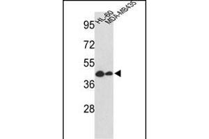 Western blot analysis of GSDMB Antibody (Center) (ABIN652499 and ABIN2842335) in HL-60, MDA-M cell line lysates (35 μg/lane). (Gasdermin B antibody  (AA 208-237))