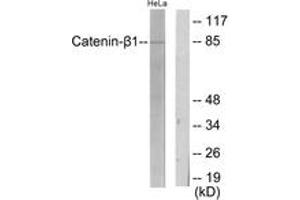 Western blot analysis of extracts from HeLa cells, using Catenin-beta1 Antibody.