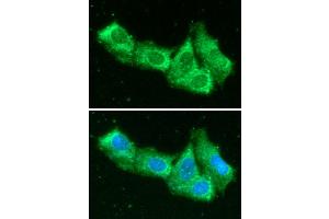 anti-EMAP-II/AIMP1 (AA 1-336) antibody