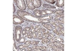 Immunohistochemical staining of human stomach with SH3TC1 polyclonal antibody  shows moderate cytoplasmic positivity in glandular cells. (SH3TC1 antibody)