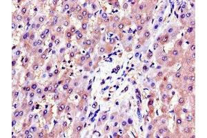 Immunohistochemistry of paraffin-embedded human liver tissue using ABIN7143701 at dilution of 1:100 (AKR1B1 antibody  (AA 114-230))