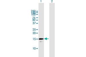Western Blot analysis of RGS21 expression in transfected 293T cell line by RGS21 MaxPab polyclonal antibody. (RGS21 antibody  (AA 1-152))