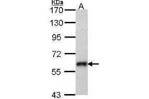 WB Image Sample (30 ug of whole cell lysate) A: Molt-4 , 7. (SOCS5 antibody  (N-Term))