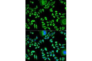 Immunofluorescence analysis of HeLa cells using CSTA antibody . (CSTA antibody  (AA 1-98))