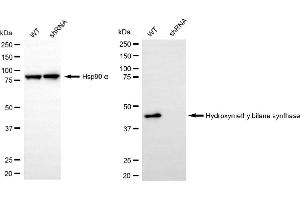 Western blotting analysis using hydroxymethylbilane synthase antibody (ABIN7799012).