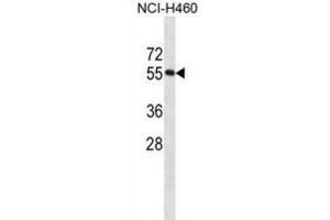 Western Blotting (WB) image for anti-RNA Binding Motif Protein 45 (RBM45) antibody (ABIN2998651)