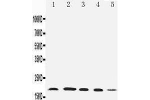 Anti-Diubiquitin antibody, Western blotting Lane 1: HELA Cell Lysate Lane 2: SKOV Cell Lysate Lane 3: MCF-7 Cell Lysate Lane 4: A549 Cell Lysate Lane 5: SMMC Cell Lysate