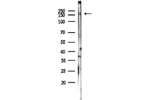 Western blot analysis of lysates from 293 cells(UV,30 min treatment), using Phospho-Ret (Tyr1062) Antibody at 1/1000 dilution.