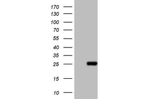 Western Blotting (WB) image for anti-ATP-Binding Cassette, Sub-Family C (CFTR/MRP), Member 5 (ABCC5) antibody (ABIN2715616)