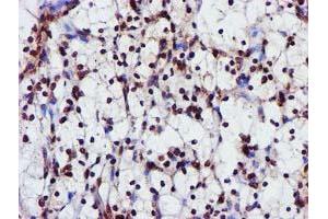 Image no. 1 for anti-Glutathione S-Transferase theta 2 (GSTT2) antibody (ABIN1498553) (GSTT2 antibody)