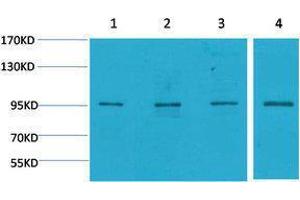 Western Blotting (WB) image for anti-Mitogen-Activated Protein Kinase 6 (MAPK6) antibody (ABIN3181516) (MAPK6 antibody)