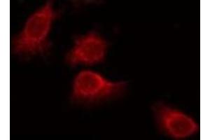 ABIN6275566 staining Hela by IF/ICC. (SH3TC1 antibody  (N-Term))