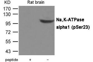 Western blot analysis of extracts from Rat brain tissue using Na,K-ATPase alpha1(Phospho-Ser23) Antibody. (ATP1A1 antibody  (pSer23))